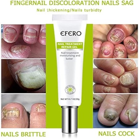 Efero Nail Treatment Repair Gel